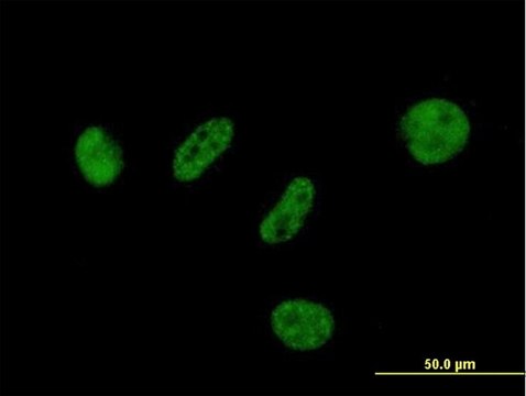 Anti-BAP1 antibody produced in mouse purified immunoglobulin, buffered aqueous solution