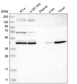 Anti-KBTBD2 antibody produced in rabbit Prestige Antibodies® Powered by Atlas Antibodies, affinity isolated antibody, buffered aqueous glycerol solution