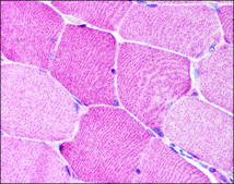 Anti-BRCC3 antibody produced in rabbit affinity isolated antibody, buffered aqueous solution