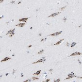 Anti-TMEM87A antibody produced in rabbit Prestige Antibodies® Powered by Atlas Antibodies, affinity isolated antibody, buffered aqueous glycerol solution