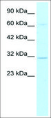 Anti-DBP (AB1) antibody produced in rabbit affinity isolated antibody