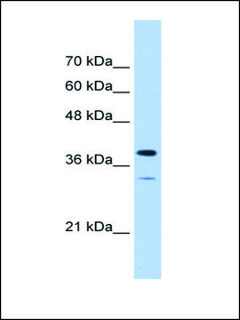 Anti-PGAM2 antibody produced in rabbit affinity isolated antibody