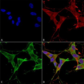 Monoclonal Anti-Lrrk2/Dardarin antibody produced in mouse clone S138-6, purified immunoglobulin