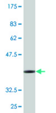 Monoclonal Anti-SGCG, (C-terminal) antibody produced in mouse clone 3C5, purified immunoglobulin, buffered aqueous solution