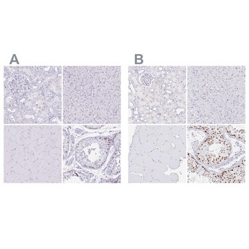 抗-CXorf67 兔抗 Prestige Antibodies&#174; Powered by Atlas Antibodies, affinity isolated antibody, buffered aqueous glycerol solution