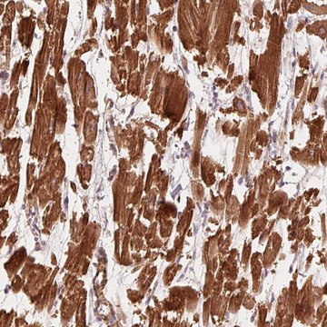 Anti-CCDC112 antibody produced in rabbit Prestige Antibodies&#174; Powered by Atlas Antibodies, affinity isolated antibody, buffered aqueous glycerol solution