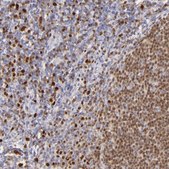 Anti-IRF8 antibody produced in rabbit affinity isolated antibody, buffered aqueous glycerol solution