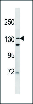 ANTI-DSPP (N-TERM) antibody produced in rabbit IgG fraction of antiserum, buffered aqueous solution