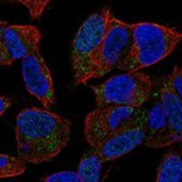 Anti-SPAG11B antibody produced in rabbit Prestige Antibodies&#174; Powered by Atlas Antibodies, affinity isolated antibody, buffered aqueous glycerol solution