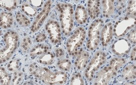 Anti-CARM1 Antibody, clone 2H11 ZooMAb® Rabbit Monoclonal recombinant, expressed in HEK 293 cells