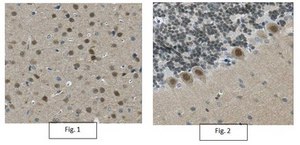 Anti-CRTC1 Antibody/TORC-1, clone 5F3.1 clone 5F3.1, from mouse