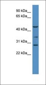 Anti-B3GALT2 antibody produced in rabbit affinity isolated antibody