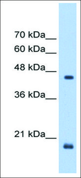 Anti-CHX10 antibody produced in rabbit affinity isolated antibody