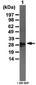 Anti-Thymosin beta-4 Antibody from rabbit, purified by affinity chromatography