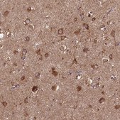 Anti-MT-CO1 antibody produced in rabbit Prestige Antibodies® Powered by Atlas Antibodies, affinity isolated antibody, buffered aqueous glycerol solution