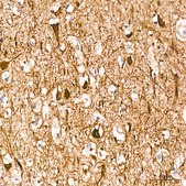 Anti-Neurofilament H Antibody, clone 7L2V7, Rabbit Monoclonal