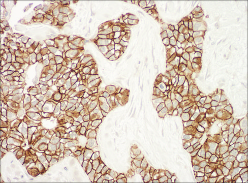 Rabbit anti-ErbB2 Antibody, Affinity Purified Powered by Bethyl Laboratories, Inc.