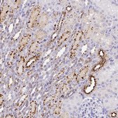 Anti-MMACHC antibody produced in rabbit Prestige Antibodies® Powered by Atlas Antibodies, affinity isolated antibody, buffered aqueous glycerol solution