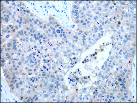 Anti-ZDHHC5 affinity isolated antibody