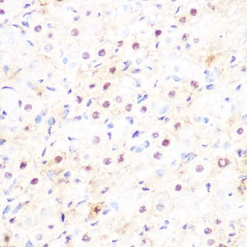 Anti-DP1/TFDP1 antibody produced in rabbit