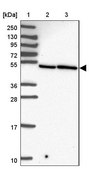 Anti-ZFP3 antibody produced in rabbit Prestige Antibodies® Powered by Atlas Antibodies, affinity isolated antibody, buffered aqueous glycerol solution