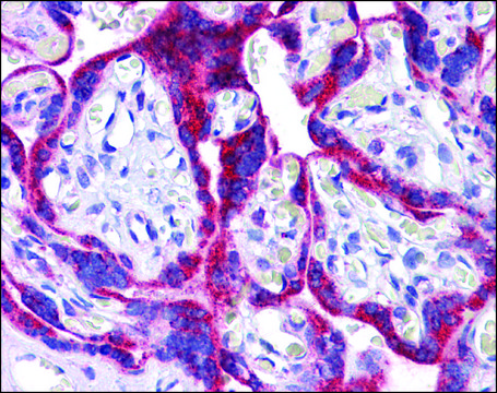 Anti-ATG9B / APG9L2 antibody produced in rabbit affinity isolated antibody