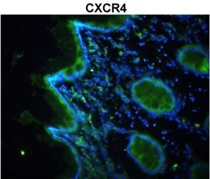 Anti-CXCR4 (N-terminal) antibody produced in rabbit affinity isolated antibody