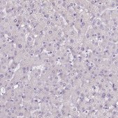 Anti-TMEM236 Prestige Antibodies® Powered by Atlas Antibodies, affinity isolated antibody