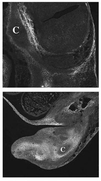 Anti-Versican Antibody, a.a. 535-598 of mouse versican Chemicon&#174;, from rabbit