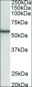 Anti-STK38 antibody produced in goat affinity isolated antibody, buffered aqueous solution