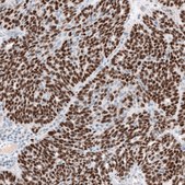 Anti-WT1 antibody produced in mouse Prestige Antibodies® Powered by Atlas Antibodies, clone CL13176, purified by using Protein A, buffered aqueous glycerol solution