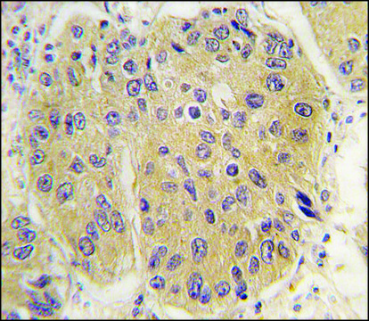 Anti-EIF4A1 (N-term) antibody produced in rabbit saturated ammonium sulfate (SAS) precipitated, buffered aqueous solution