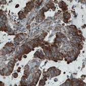 Monoclonal Anti-MCL1 antibody produced in mouse Prestige Antibodies&#174; Powered by Atlas Antibodies, clone CL1128, purified immunoglobulin, buffered aqueous glycerol solution
