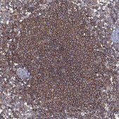 Anti-DOCK8 antibody produced in rabbit Prestige Antibodies® Powered by Atlas Antibodies, affinity isolated antibody, buffered aqueous glycerol solution