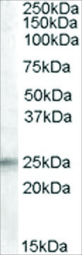 Anti-IGFBP6 antibody produced in goat affinity isolated antibody, buffered aqueous solution