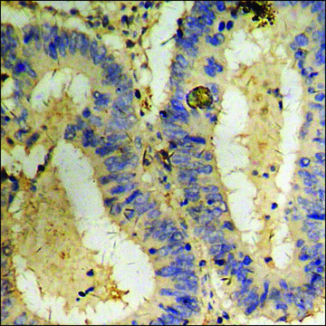 Anti-phospho-CD71/TfR (pSer24) antibody produced in rabbit affinity isolated antibody