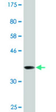 Monoclonal Anti-RBM10 antibody produced in mouse clone 2F12, purified immunoglobulin, buffered aqueous solution