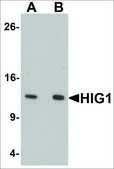 Anti-HIGD1A antibody produced in rabbit affinity isolated antibody