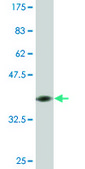 Monoclonal Anti-K6HF antibody produced in mouse clone 2E3, ascites fluid