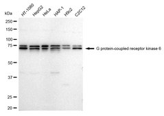 Anti G protein-coupled receptor kinase 6 Antibody, clone 23GB1500, Rabbit Monoclonal clone 23GB1500, recombinant rabbit monoclonal, expressed in HEK293 cells