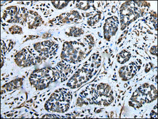 Anti-ATAD1 affinity isolated antibody