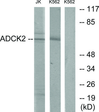 Anti-ADCK2 antibody produced in rabbit affinity isolated antibody