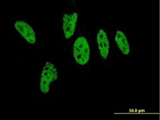 Monoclonal Anti-EP300 antibody produced in mouse clone 1B1, purified immunoglobulin, buffered aqueous solution