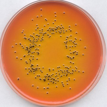 SS agar for the isolation of salmonellae and shigellae