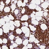 Anti-SLC4A1 antibody produced in rabbit Prestige Antibodies® Powered by Atlas Antibodies, affinity isolated antibody, buffered aqueous glycerol solution