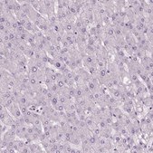 Anti-ELOVL3 antibody produced in rabbit Prestige Antibodies® Powered by Atlas Antibodies, affinity isolated antibody, buffered aqueous glycerol solution