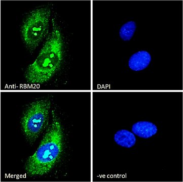 Anti-RBM20 antibody produced in goat affinity isolated antibody, buffered aqueous solution