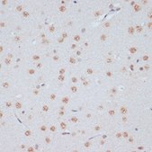 Anti-Phospho-ERK1-T202/Y204 + ERK2-T185/Y187 antibody produced in rabbit