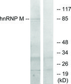 Anti-HNRNP M antibody produced in rabbit affinity isolated antibody