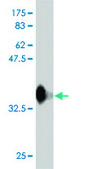 Monoclonal Anti-RFWD3 antibody produced in mouse clone 6B4, purified immunoglobulin, buffered aqueous solution